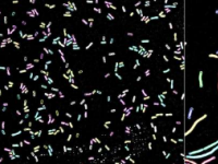 揭示了调节细菌病原体克雷伯氏菌细胞分裂的新机制